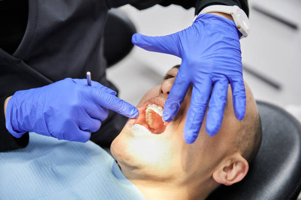 Best Emergency Root Canal Treatment in Lockport, LA