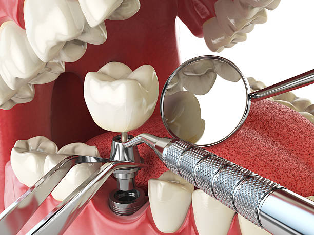 Best Walk-In Emergency Dentist in Lockport, LA